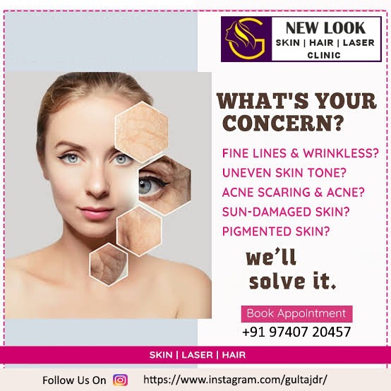 New Look SkinHair Laser Clinic, Best Skin Treatment in Indiranagar, Skin Treatment in Indiranagar, Acne Treatment in Indiranagar, Best Acne Treatment in Indiranagar