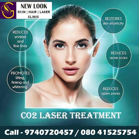 New Look SkinHair Laser Clinic, Best CO2 Laser Treatment in  Domlur Bangalore, CO2 Laser Treatment in  Domlur Bangalore, Best CO2 Laser Treatment in  Indiranagar, Bangalore