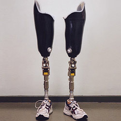 Above Knee Prosthetic Leg Evolution Above Knee Prosthetic Leg Manufacturers In Hyderabad Above Knee