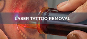 Renovin Skin Care, Best Skin Doctor for Laser Tattoo Removal in Zirakpur,Skin Doctor for Laser Tattoo Removal in Zirakpur,Tattoo Removal services in Zirakpur,permanent Tattoo Removal in Zirakpur
