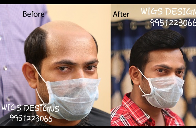 Hair Bonding in Hyderabad @9951223066 | WIGS DESIGNS | Hair Bonding in  Falaknuma, Hair Bonding in