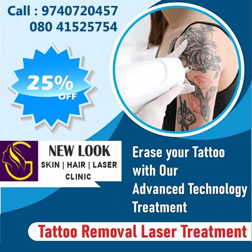 New Look SkinHair Laser Clinic, Best Tattoo Removal Laser Treatment in Domlur Bangalore, Tattoo Removal Laser Treatment in Domlur Bangalore, Best Tattoo Removal Laser Treatment in Indiranagar Bangalore