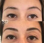 Renovin Skin Care, Microblading in ZIRAKPUR, Permanent makeup in Zirakpur, Skin Specialist on VIP Road zirakpur, Skin clinic in Zirakpur, Dermatologist in ZIRAKPUR, Skin specialist in Zirakpur, Skin Doctor in zirakpur