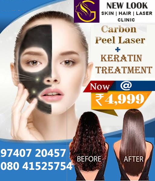 New Look SkinHair Laser Clinic, Keratin Treatment and Carbon Peel Laser Treatment Indira Nagar, Bangalore,  Best Keratin Treatment and Carbon Peel Laser Treatment Indira Nagar Bangalore,