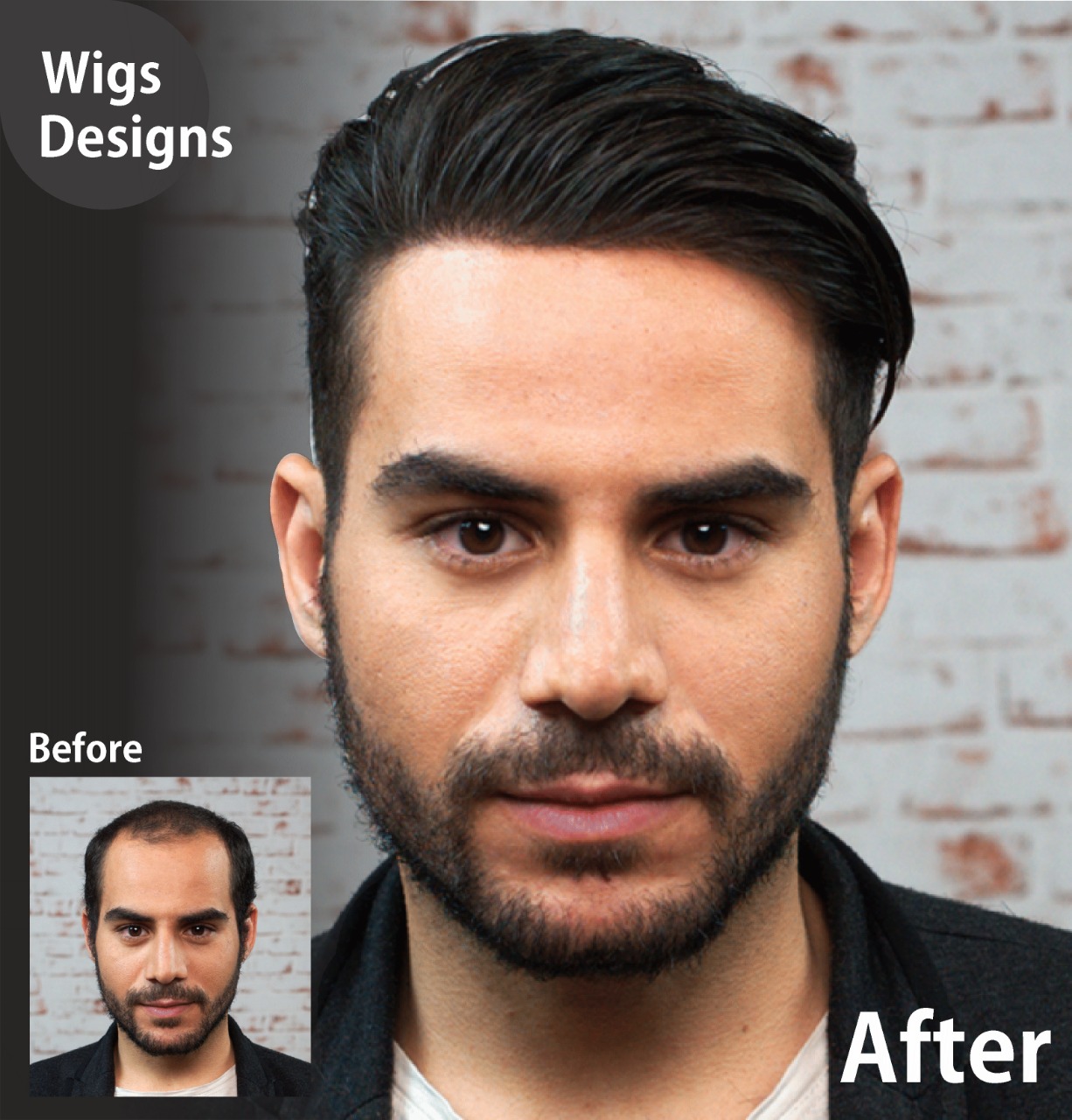 Hair Patch in Hyderabad @9951223066 | WIGS DESIGNS | Hair Patch in  Fathenagar, Hair Patch in