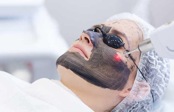 New Look SkinHair Laser Clinic, Carbon Laser Peel Treatment In Indiranagar Bangalore, Carbon Laser Peel Treatment In Domlur Bangalore, Carbon Laser Peel Clinic In Bangalore,