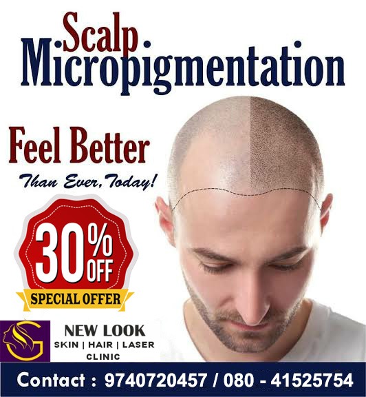 Best Scalp Micropigmentation Treatment in Domlur, Bangalore | New Look SkinHair Laser Clinic | Best Scalp Micropigmentation Treatment in Domlur Bangalore, Scalp Micropigmentation Treatment in Domlur, Bangalore - GL103961