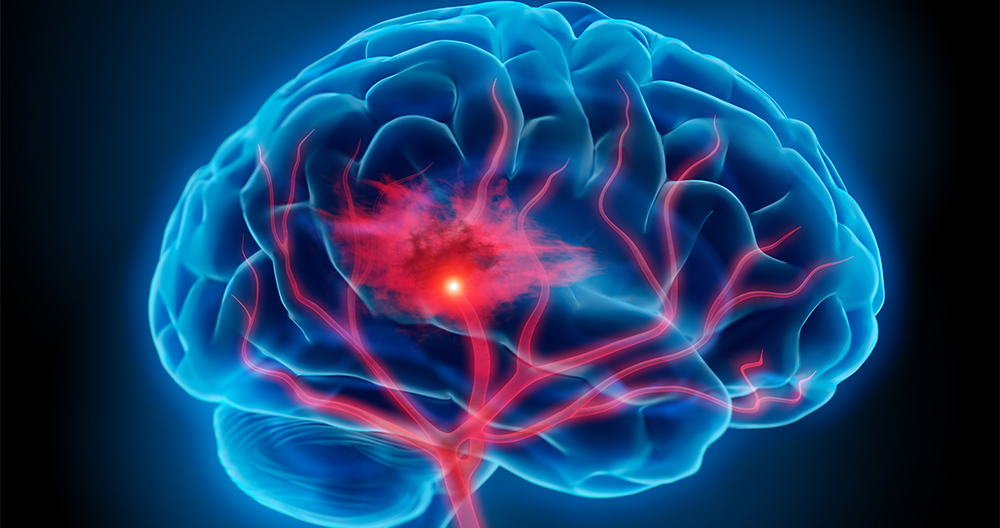 Neuro Hospital in Jabalpur | Anant Hospital | Neuro Hospital in Jabalpur, best neuro hospital Jabalpur, neuro surgeon in Jabalpur, neurologist in Jabalpur, top neuro hospital in jabalpur, no 1 neuro hospital in Jabalpur, best neuro care hospital  - GL119504