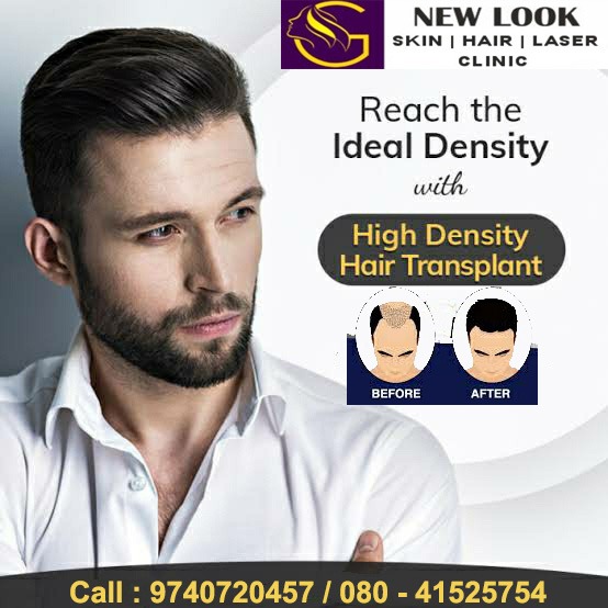 New Look SkinHair Laser Clinic, Best Hair Transplant Treatment in Indiranagar, Hair Transplant Treatment in Indiranagar , Beard Transplant In Indiranagar, Best Beard Transplant In Indiranagar, Hair Transplant Treatment Near Me