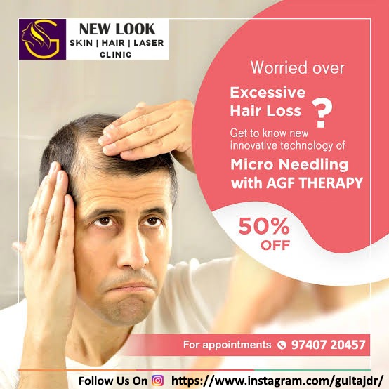 New Look SkinHair Laser Clinic, Best Hair Loss Treatment in Indiranagar,  Hair Loss Treatment in Indiranagar, 