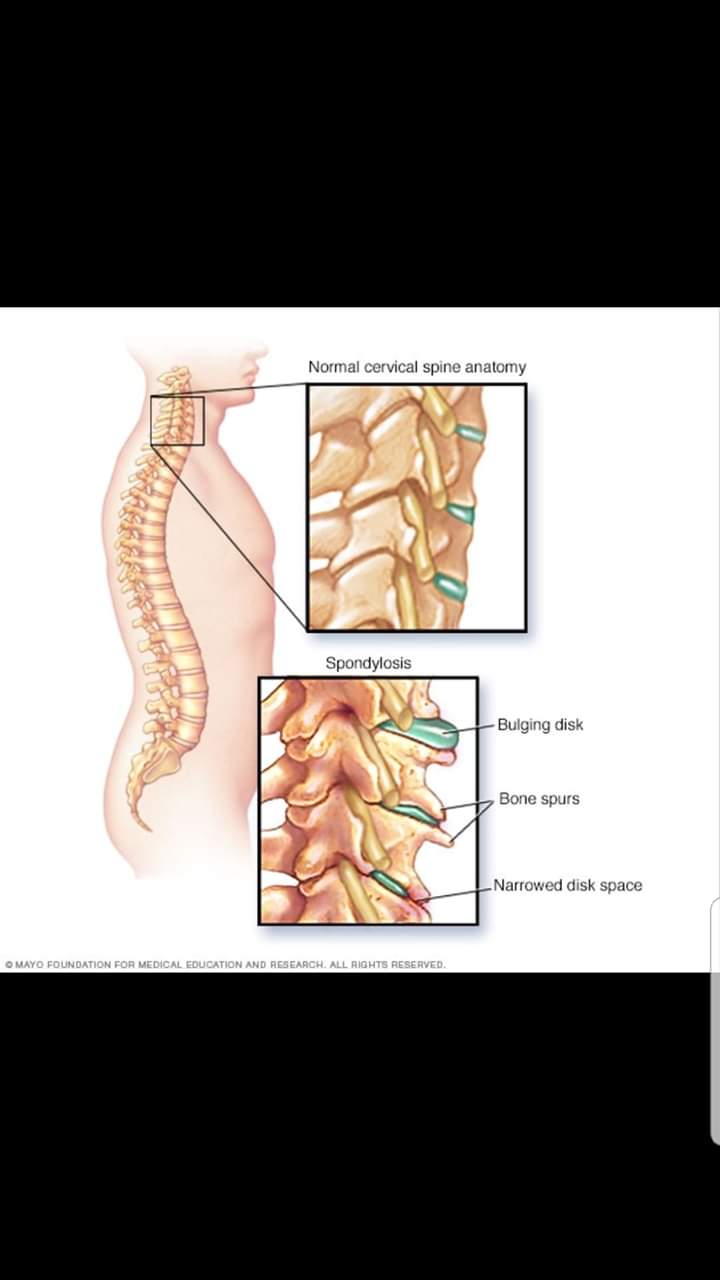 Lumbar spondylysis  | Tejasvini Kerala Ayurveda | Slip disc treatment in chandigarh 
Lumbar spondylysis treatment in chandigarh 
Back pain treatment in tricity 
Ayurvedic treatment of back pain  - GL62104