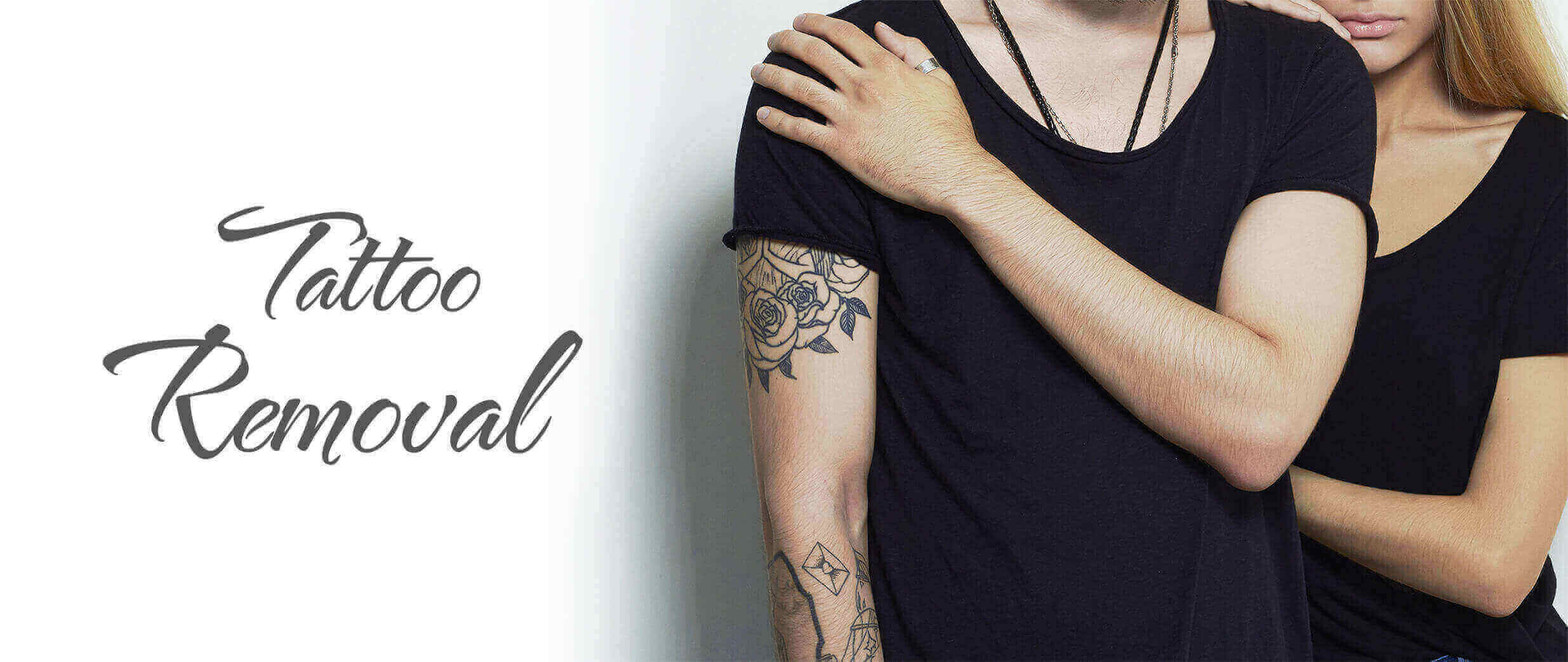 Renovin Skin Care, Permanent Tattoo Removal in zirakpur,Tattoo Removal in zirakpur,Tattoo Removal services in zirakpur,Permanent Tattoo Removal services in zirakpur