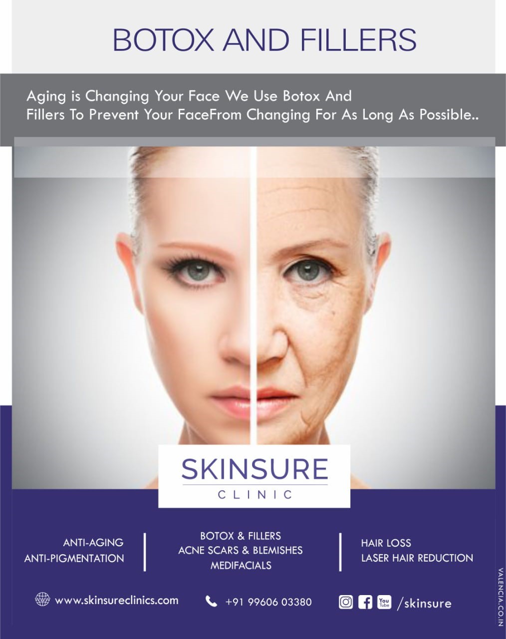 BOTOX AND FILLERS | SkinSure Clinic | BEST DERMATOLOGISTS ...