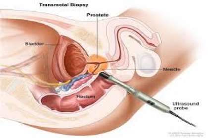 Consultant Urologist & Andrologist, UROLOGIST IN JM ROAD, UROLOGY SPECIALIST IN JM ROAD, BEST UROLOGIST IN JM ROAD, UROLOGY DOCTOR IN JM ROAD, UROLOGY TREATMENT IN JM ROAD, UROLOGY CLINIC IN JM ROAD, BEST UROLOGY DOCTOR IN JM ROAD,BEST.