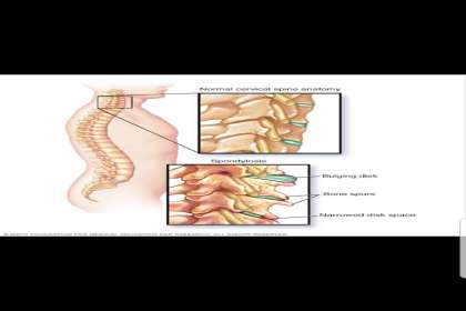 Tejasvini Kerala Ayurveda, Slip disc treatment in chandigarh 
Lumbar spondylysis treatment in chandigarh 
Back pain treatment in tricity 
Ayurvedic treatment of back pain 