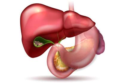 Dr. Abhineet Jain (Piles Specialist in Jabalpur), best stone doctor in Jabalpur, best gallstone doctor in Jabalpur, stone remove in Jabalpur, gallstone surgeon in Jabalpur, best gallstone surgeon in Jabalpur, gallstone treatment in Jabalpur