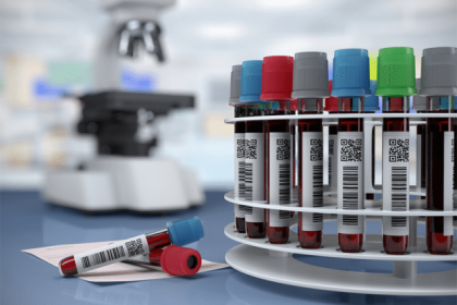 Godbole Laboratory, Best Pathologist In Pune, Home Collection Blood Test In Pune, Affordable Pathlab Near Me In Pune